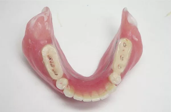 寒川駅1分で「噛める入れ歯／専門・名医」｜寒川駅前ファースト歯科